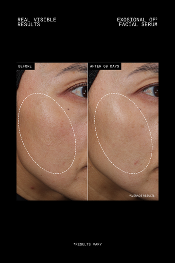 Youth Boost ExoSignal GF² Facial Serum